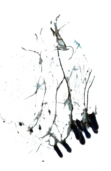 A microscopic image shows filamentous fungal structures with clusters of spores at the tips, set against a dark background.
